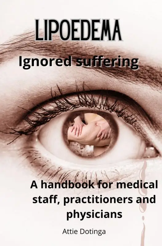 Lipoedema